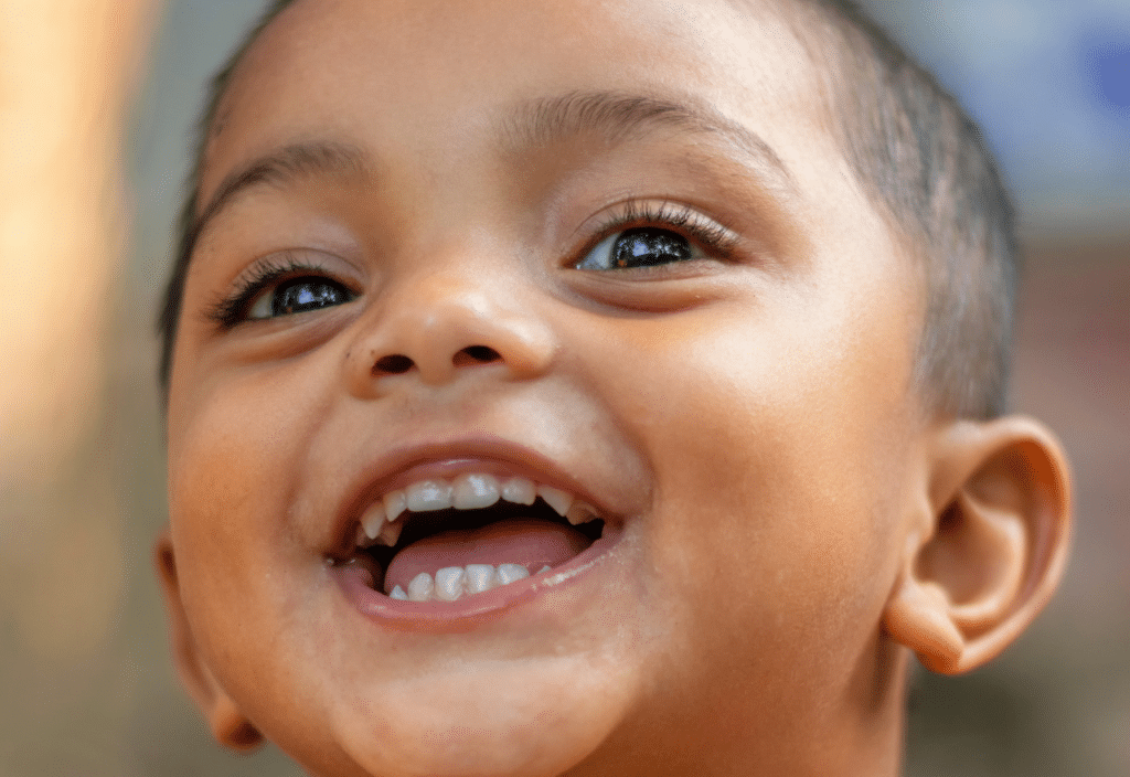 Crooked Baby Teeth: Should You Be Concerned?